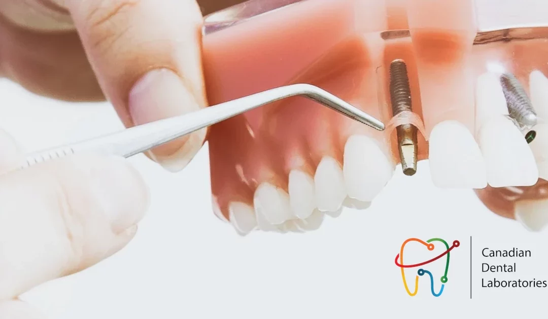 Canadian Dental Labs partners with Hallmark Dental, expanding footprint into Atlantic Canada